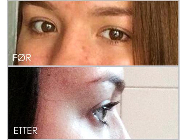 Celina Stamper viser virkningen av vippeserum